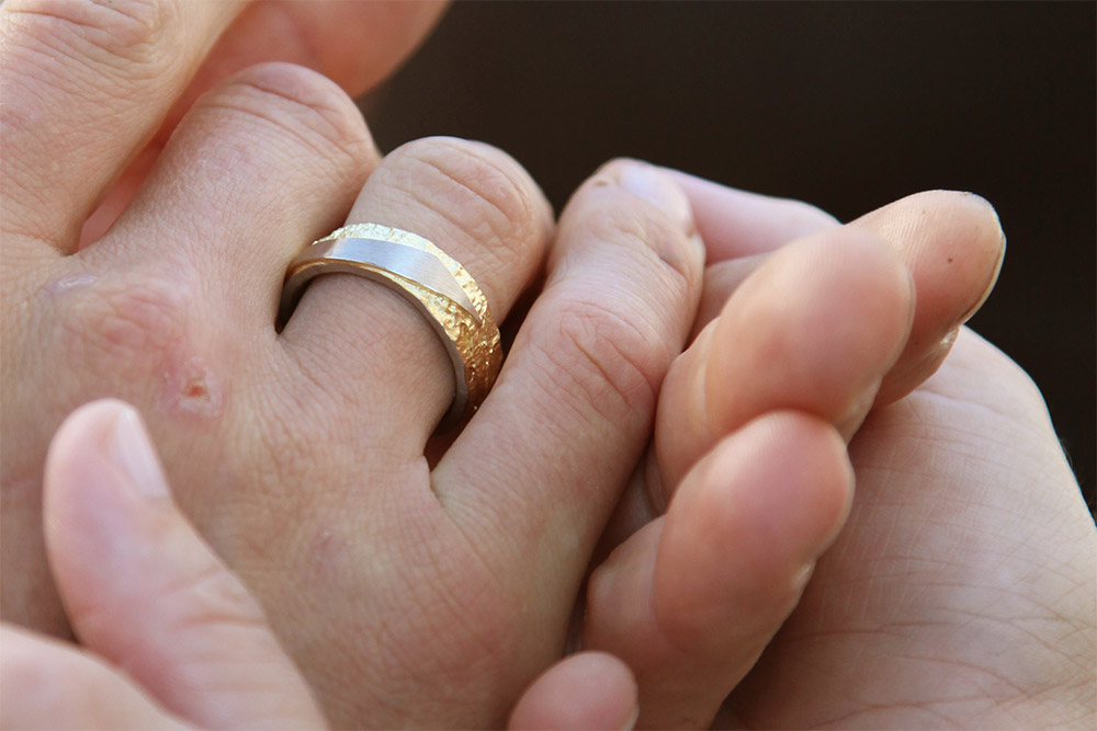 Symbolfoto einer Hand mit Ehering